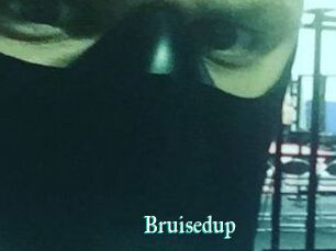 Bruisedup