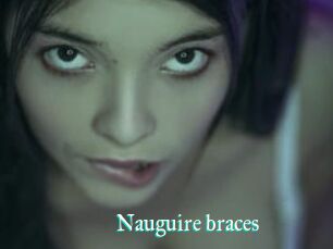 Nauguire_braces