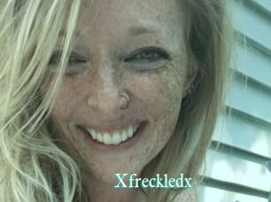 Xfreckledx
